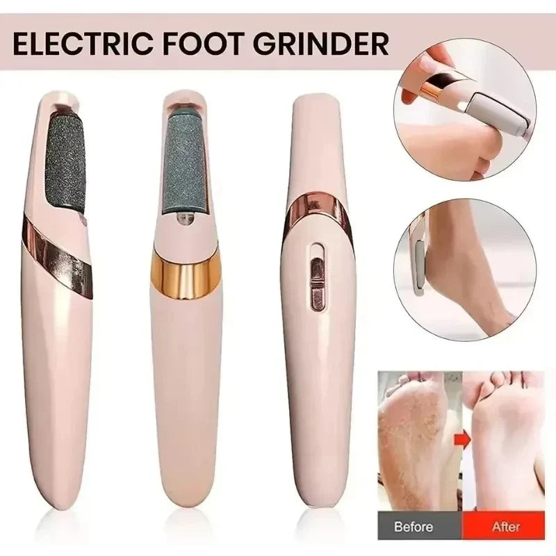Magic Electric Foot Callus Remover